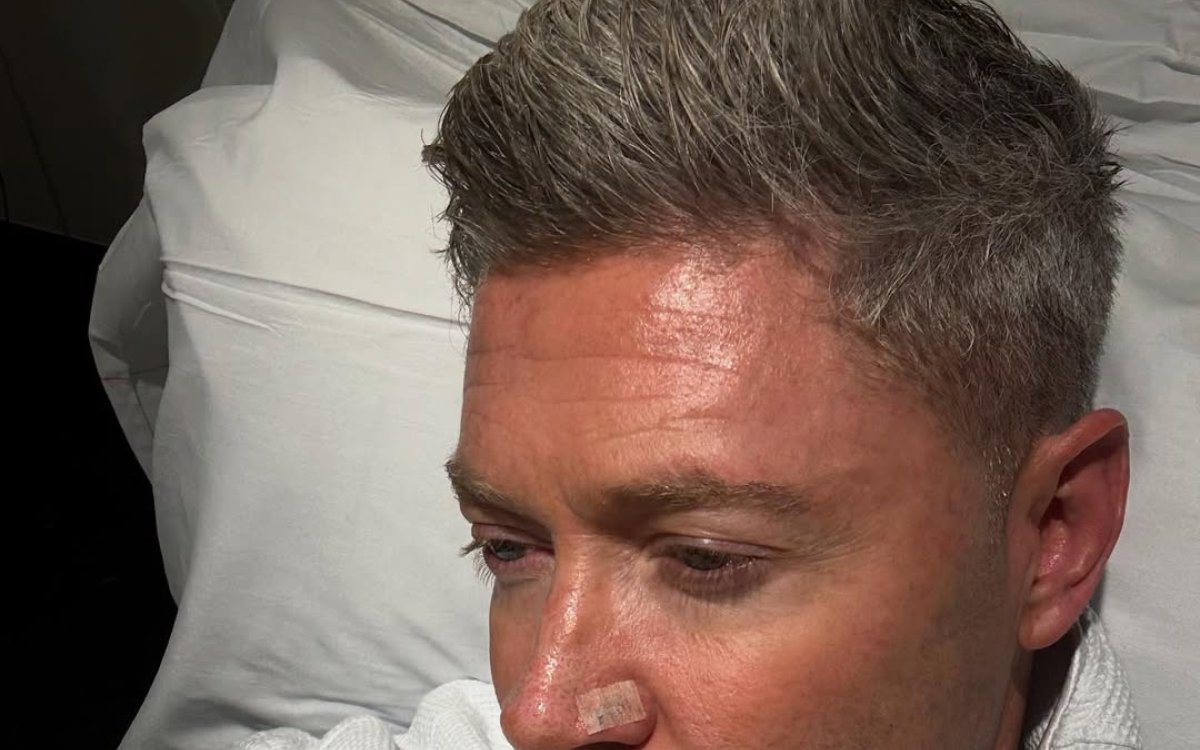 'I've had seven basal cells cut out of my face': Michael Clarke on his battle with skin cancer