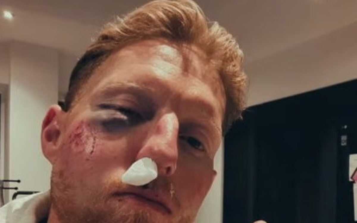 'Cricket balls do serious damage': Stokes vows to 'always wear helmet' after facial injury